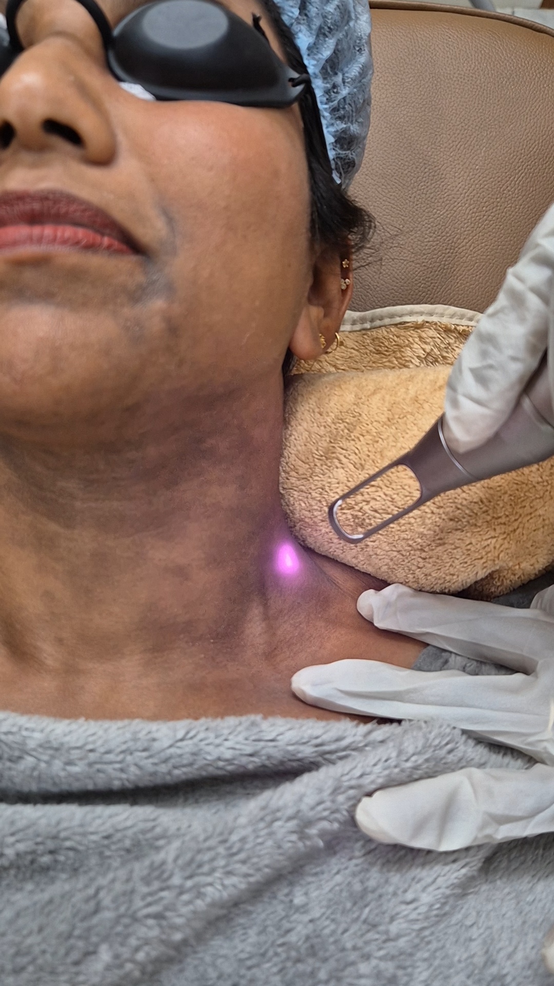 LPP Laser Story